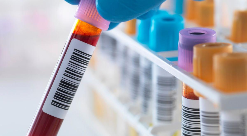 Blood Sample Collection